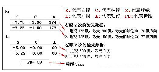 眼科醫(yī)生教你如何一分鐘看懂驗(yàn)光單！